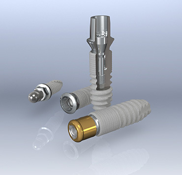 Dental Implants